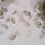 yorkshire koi society Chilodonella image